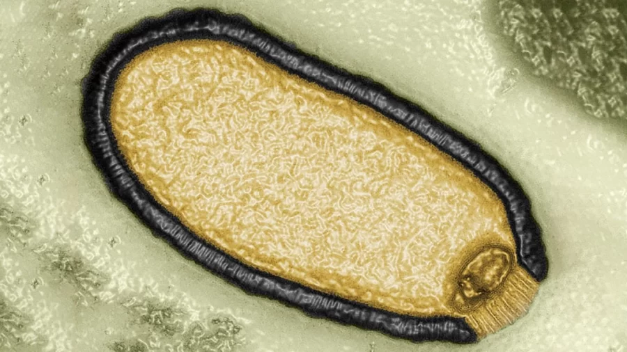 A virus that was isolated from a 30,000-year-old sample of permafrost. Picture by Jean-Michel Claverie