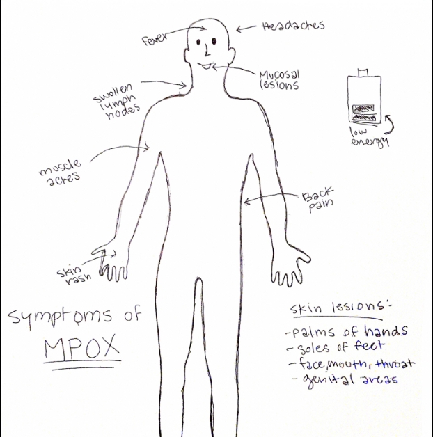 A drawn diagram of the symptoms of MPOX